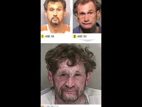 Disturbing Before And After Pictures Of Drug Abuse - It's Gonna Save Your Life- Meth